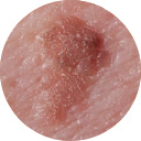 hpv阳性