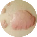 性 病